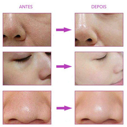 Escova de limpeza facial giratória