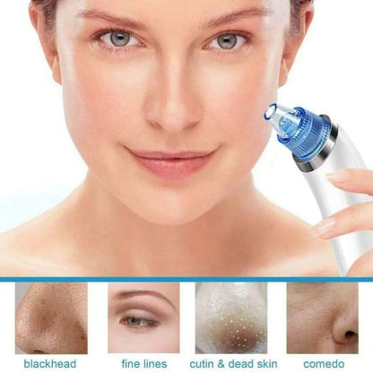 Limpa Poros Facial - DermaSuction