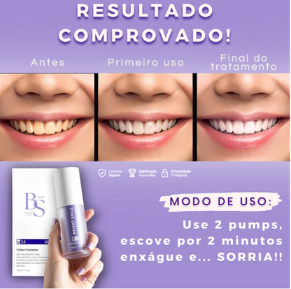 SmileKit - Gel Roxo Branqueador de Dentes